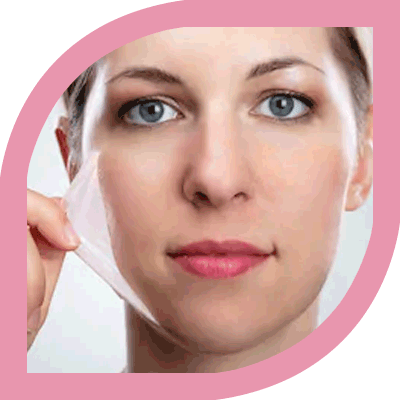 Best Chemical Peel Treatment Clinic in Delhi